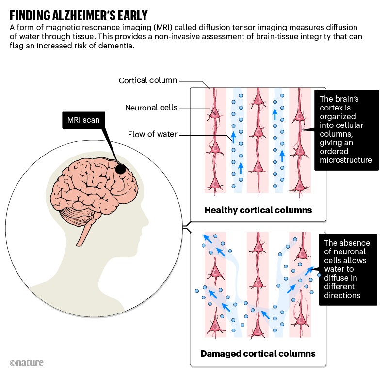 Oxford Brain Diagnostics: turning MRI into a diagnosis tool for