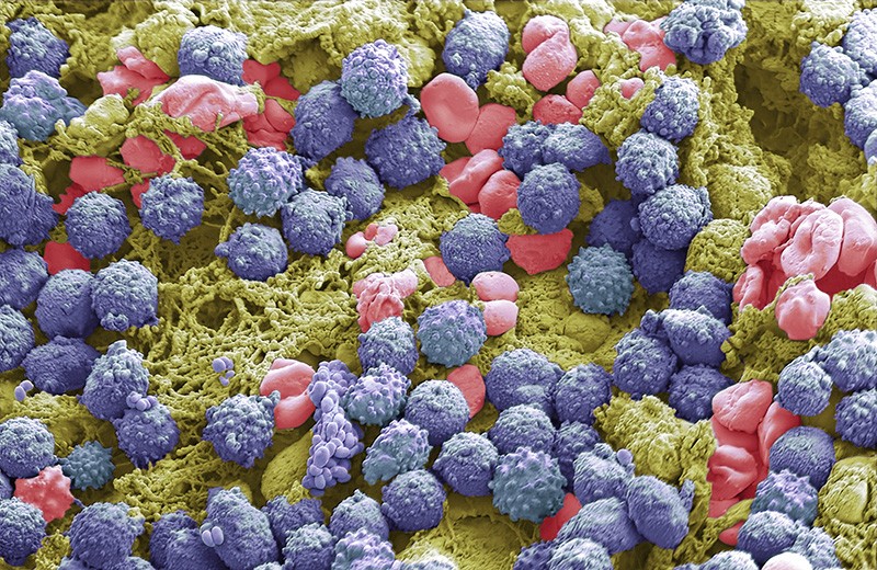 tirzepatide australia cost TrimRX tirzepatide australia cost TrimRX