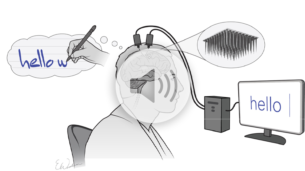 The brain implant that turns thoughts into text