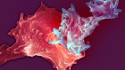 The trick that could inject new life into an old tuberculosis vaccine