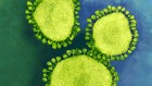 China coronavirus: labs worldwide scramble to analyse live samples
