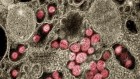 COVID research updates: Good timing might help the immune system to control COVID-19