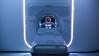 Making radiation oncology more personal