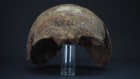 A hunter-gather’s tooth yields the oldest known strain of plague