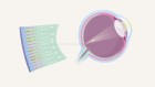 A visual guide to repairing the retina