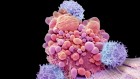 Last-resort cancer therapy holds back disease for more than a decade