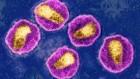 Highly virulent HIV variant found circulating in Europe