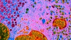 Cold treatment for insulin-making cells points to diabetes cure