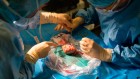 First pig kidneys transplanted into people: what scientists think