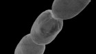 Largest bacterium ever found is surprisingly complex