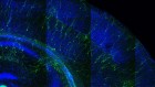 Hybrid brains: the ethics of transplanting human neurons into animals