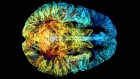 Severe COVID could cause markers of old age in the brain