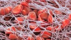 Researchers welcome $3.5-million haemophilia gene therapy — but questions remain