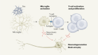 Activated immune cells drive neurodegeneration in an Alzheimer’s model