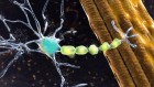 备受期待的ALS药物可能为更多的脑部治疗铺平道路