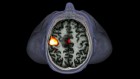 Brain imaging: fMRI advances make scans sharper and faster
