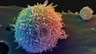 CRISPR-based方法使T细胞,阻止青少年癌症