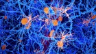 The brain cells linked to protection against dementia