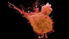 Cancer trial results show power of weaponized antibodies