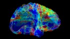 AI that reads brain scans shows promise for finding Alzheimer’s genes
