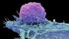 Turbocharged CAR-T cells melt tumours in mice — using a trick from cancer cells