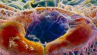 The surprising link between gut bacteria and devastating eye diseases