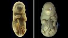 Scientists made a six-legged mouse embryo — here’s why