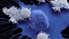 Do cutting-edge CAR-T-cell therapies cause cancer? What the data say