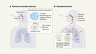 First encounter with SARS-CoV-2: immune portraits of COVID susceptibility