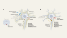 Obesity is driven by a build-up of molecular mesh around hunger neurons