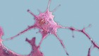 Breast-cancer cells enlist nerves to spread throughout the body