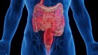 The mysteries of inflammatory bowel disease are being cracked — offering hope for new therapies