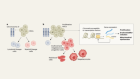 Childhood leukaemia in Down’s syndrome primed by blood-cell bias