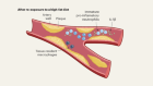 Yo-yo dieting accelerates cardiovascular disease by reprogramming the immune system