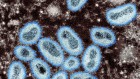 Monkeypox virus keeps getting better at spreading among humans