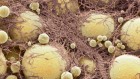 Fat cells have a ‘memory’ of obesity — hinting at why it’s hard to keep weight off