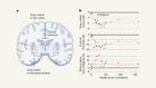 Pregnancy restructures the brain to prepare for childbirth and parenthood