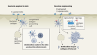 Skin in the game — locally made antibodies fight resident bacteria