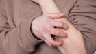 Why it feels good to scratch that itch: the immune benefits of scratching