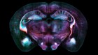 ‘Fear extinction’ signal in mouse brain offers clues about how to treat PTSD