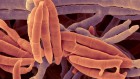 Fungus from the human gut slows liver disease in mice