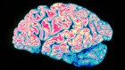 China’s dementia incidence is rising fast ― outpacing the global average