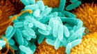 Microbe that infests hospitals can digest medical-grade plastic ― a first