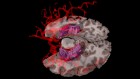 How CAR-T cancer therapies could harm the brain