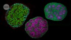 Brain tissues, assemble! Inside the push to build better brain models