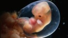 Stem cells coaxed into most advanced amniotic sacs ever grown in the lab