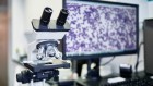 How artificial intelligence is transforming pathology