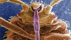 Bed bugs boomed as the world’s first cities did