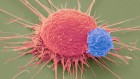 Cancer fighting CAR-T cells show promising results for hard-to-treat tumours