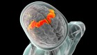 World first: brain implant lets man speak with expression ― and sing